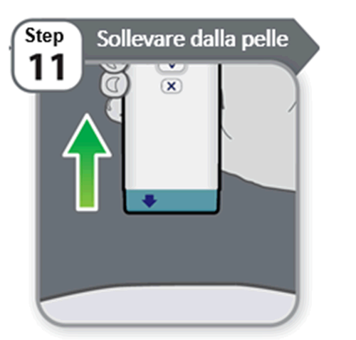 Sollevare dalla pelle indicato da freccia verde su area grigia e blu con simbolo a croce e istruzioni numerate Step 11