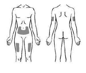 Schema corporeo femminile con aree ombreggiate che indicano possibili siti di iniezione sottocutanea su addome e cosce