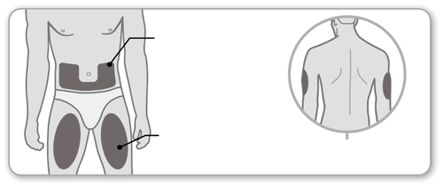 Schema del corpo umano con aree evidenziate per iniezione sottocutanea addominale e glutei con ingrandimento della schiena