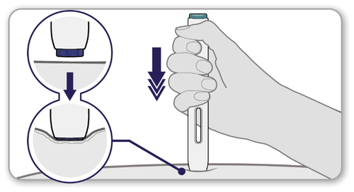 Mano che tiene un dispositivo autoiniettante con freccia che indica la pressione verso il basso e ingrandimento del meccanismo di iniezione