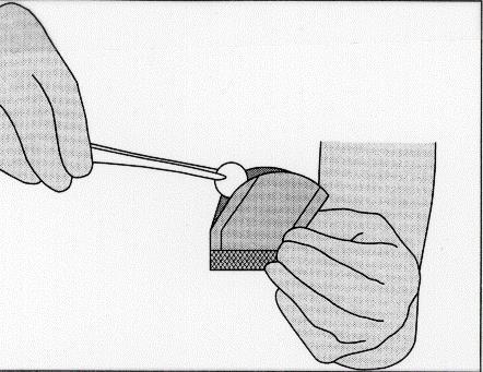 Mano che utilizza una pinzetta per posizionare un batuffolo di cotone su un’area cutanea preparata per l’iniezione