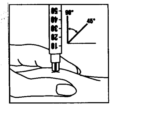 Mano che tiene una siringa inclinata a 45 gradi mentre inietta il farmaco sotto la pelle del braccio con indicazioni di profondit&agrave;