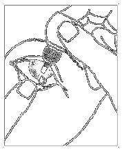 Siringa con ago inserito nella pelle, tecnica di iniezione sottocutanea con piega cutanea creata dalle dita