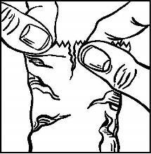 Due dita che pizzicano la pelle, creando una piega per illustrare il corretto posizionamento di un