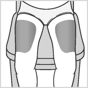 Scheletro pelvico stilizzato con evidenziate le articolazioni sacroiliache e la sinfisi pubica