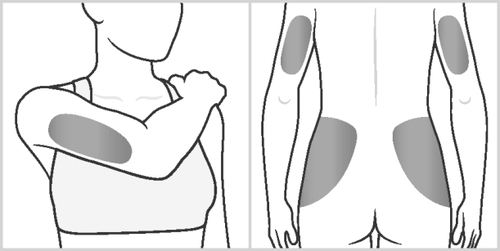 Schizzi di braccia umane con aree grigie che indicano i siti di iniezione intramuscolare deltoide e gluteo