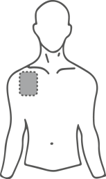 Schema del torso umano con area ombreggiata sulla parte superiore del braccio indicante il sito di iniezione