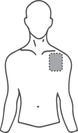 Schema del torace umano con area ombreggiata sul lato destro indicante il sito di iniezione
