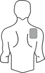 Schema del corpo umano stilizzato con area ombreggiata sulla parte superiore del braccio destro