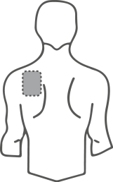 Schema del torso umano con area ombreggiata a livello del deltoide superiore del braccio destro