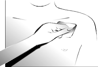 Mano che stringe una siringa preriempita con ago rivolto verso la pelle del braccio per iniezione sottocutanea