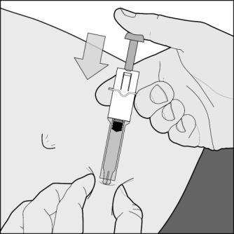 Mano che tiene un autoiniettore con ago rivolto verso la pelle e freccia che indica la pressione verso il basso