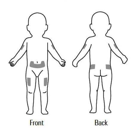 Schema corporeo stilizzato con aree ombreggiate su braccia, fianchi e cosce indicando possibili siti di iniezione frontali e dorsali