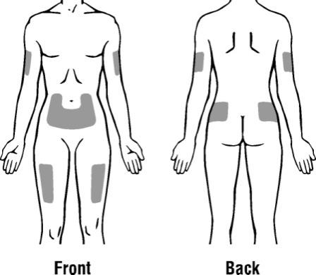 Schema corporeo umano con aree ombreggiate che indicano possibili siti di applicazione di cerotti medicinali su fronte, addome e schiena