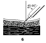 Siringa con ago che penetra nel tessuto sottocutaneo con angolo tra 45 e 90 gradi indicati in alto