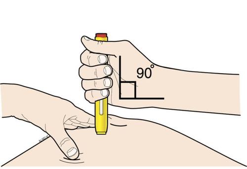 Mano che tiene una penna per iniezione gialla ad angolo retto sulla pelle del braccio con indicazione di 90 gradi