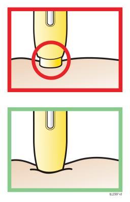 Penna iniettabile gialla con ago evidenziato da cerchio rosso e corretta posizione di iniezione sulla pelle beige