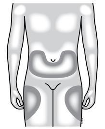 Schema del corpo umano con aree ombreggiate che indicano possibili siti di iniezione sottocutanea addominale e laterale