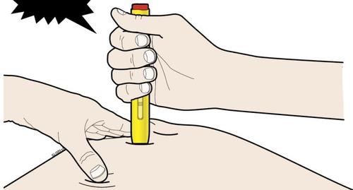 Mano che stringe un autoiniettore giallo puntato verso la pelle del braccio, con l