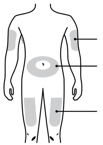 Schema del corpo umano con aree grigie che indicano possibili siti di iniezione sottocutanea su braccia, cosce e addome