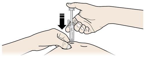 Mano che afferra una siringa con ago inserito nella pelle, freccia nera indica la direzione di iniezione sottocutanea