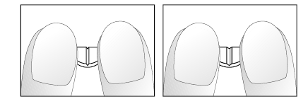 Due disegni schematici di una valvola nasale con apertura e chiusura delle narici vista frontale