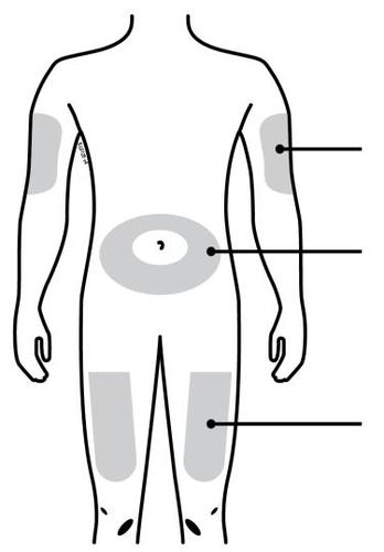 Schema del corpo umano con aree ombreggiate che indicano siti di iniezione sottocutanea su addome, braccia e cosce