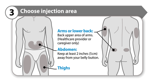 Schema corporeo con aree di iniezione evidenziate: braccia, schiena, addome e cosce con indicazioni testuali