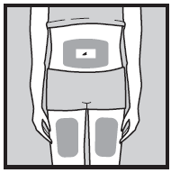 Schema del corpo umano con area grigia che indica la zona di iniezione addominale e dispositivo medico applicato