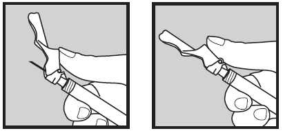 Mano che tiene una siringa preriempita con ago inserito nel dispositivo di connessione a valvola per infusione