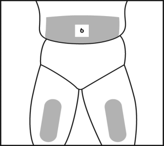 Parte inferiore del corpo umano con aree grigie che indicano i siti di iniezione intramuscolare nelle natiche
