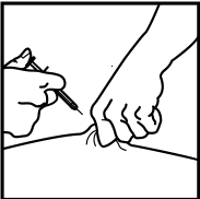 Mano che stringe una siringa con ago inserito nella pelle del braccio, tecnica di iniezione sottocutanea illustrata con linee semplici