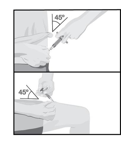 Iniezione sottocutanea con siringa a 45 gradi nel braccio, angolo indicato, dettaglio della mano che esegue l