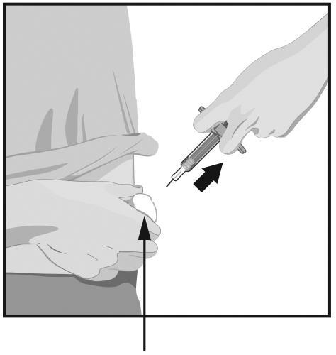 Iniezione sottocutanea con siringa: mano che tiene la siringa e l