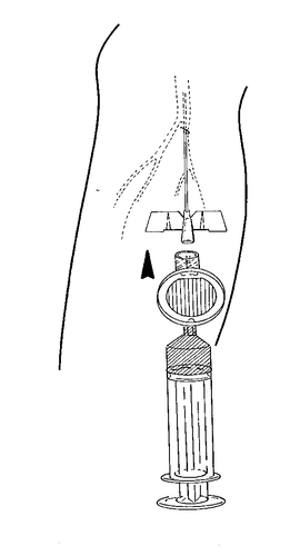 Siringa con ago inserito nella pelle, freccia che indica la direzione di iniezione e sezione trasversale del pistone