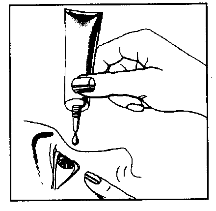 Mano che applica una goccia di collirio nell