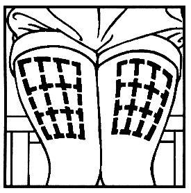 Due glutei stilizzati con indicazioni di possibili siti di iniezione intramuscolare evidenziati da croci e linee