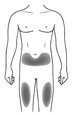 Schema del corpo umano con evidenziate le aree di iniezione nell