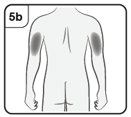 Schizzo del dorso umano con indicazione delle aree di iniezione intramuscolare nelle spalle e glutei con un segno centrale verticale