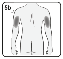 Schiena umana con indicazione delle zone di iniezione intramuscolare nelle spalle e glutei con croci nere