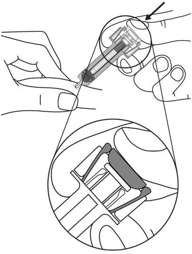 Siringa pre-riempita con ago inserito nel tessuto sottocutaneo e ingrandimento del meccanismo di sicurezza attivato