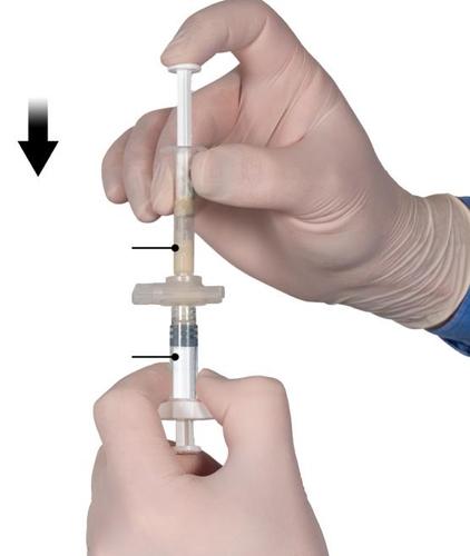 Mano con guanto che tiene una siringa preriempita con farmaco liquido e ago protetto da cappuccio di sicurezza
