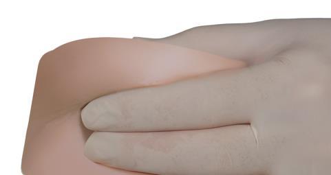 Mano guantata che solleva un plica di pelle, dimostrando la tecnica di iniezione sottocutanea su un braccio simulato