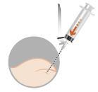 Siringa pre-riempita con ago inserito sotto la pelle, sezione trasversale del tessuto sottocutaneo e muscolare visibile