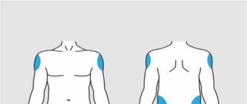 Schema corporeo con evidenziate in blu le aree di iniezione intramuscolare deltoidea anteriore e laterale