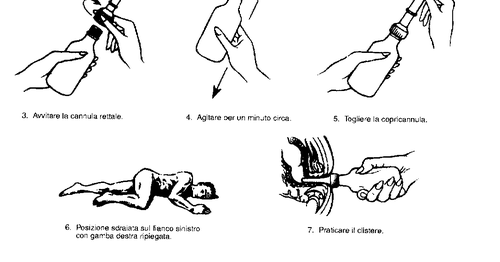 Preparazione e iniezione del farmaco con istruzioni numerate e disegni di mani che maneggiano la penna e paziente sdraiato
