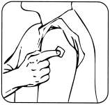 Mano che pizzica la pelle del braccio con il pollice e l