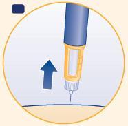 Penna iniettabile con ago sottile inserito nella pelle, freccia blu indica la direzione dell