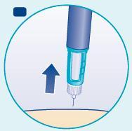 Penna per iniezione con ago inserito nella pelle beige, freccia blu indica direzione verso l