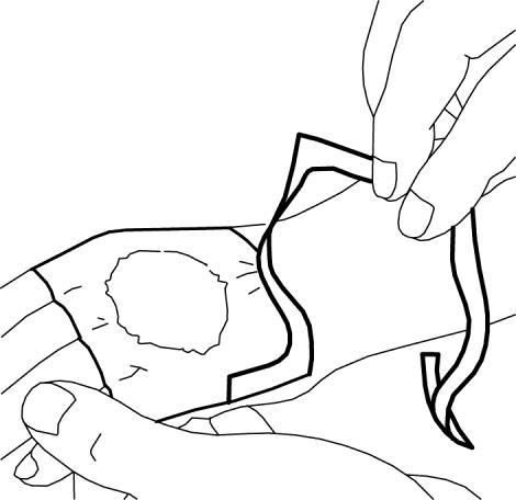 Mano che applica un cerotto adesivo su una ferita aperta con contorni irregolari e una protezione in plastica trasparente